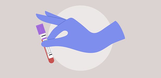 Cizzle Biotech signs LOI to bring early lung cancer blood test to NHS 