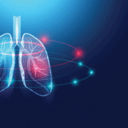 Optellum, AI lung cancer diagnosis innovator, secures $14M Series A funding to accelerate expansion